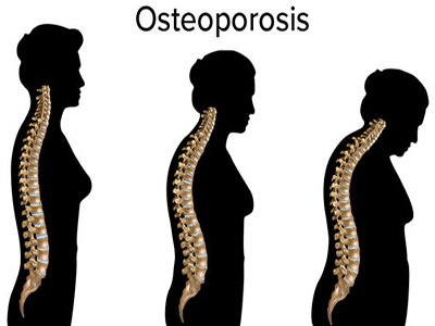 Dr. Supriya Khandelwal Physio Expert in mathura, Experienced Physiotherapy in Mathura, best physiotherapist in Mathura, Joints Pain Treatment in Mathura , Paralysis treatment in mathura, Sports Injury treatment in mathura, Cervical Pain treatment in mathura